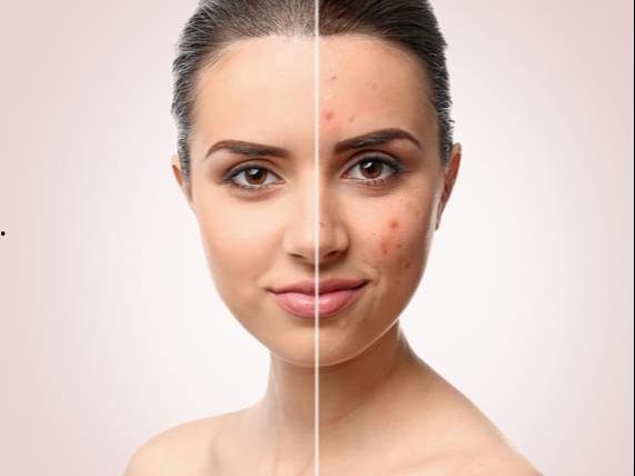 痘痘都都都都吃瓜,揭秘吃瓜背后的健康秘密